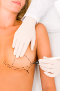 breast lift